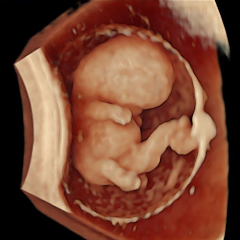 3D Image of an embryo at 8 weeks captured at our Viability Scan. This is one of the Early Pregnancy Scans we offer in London.