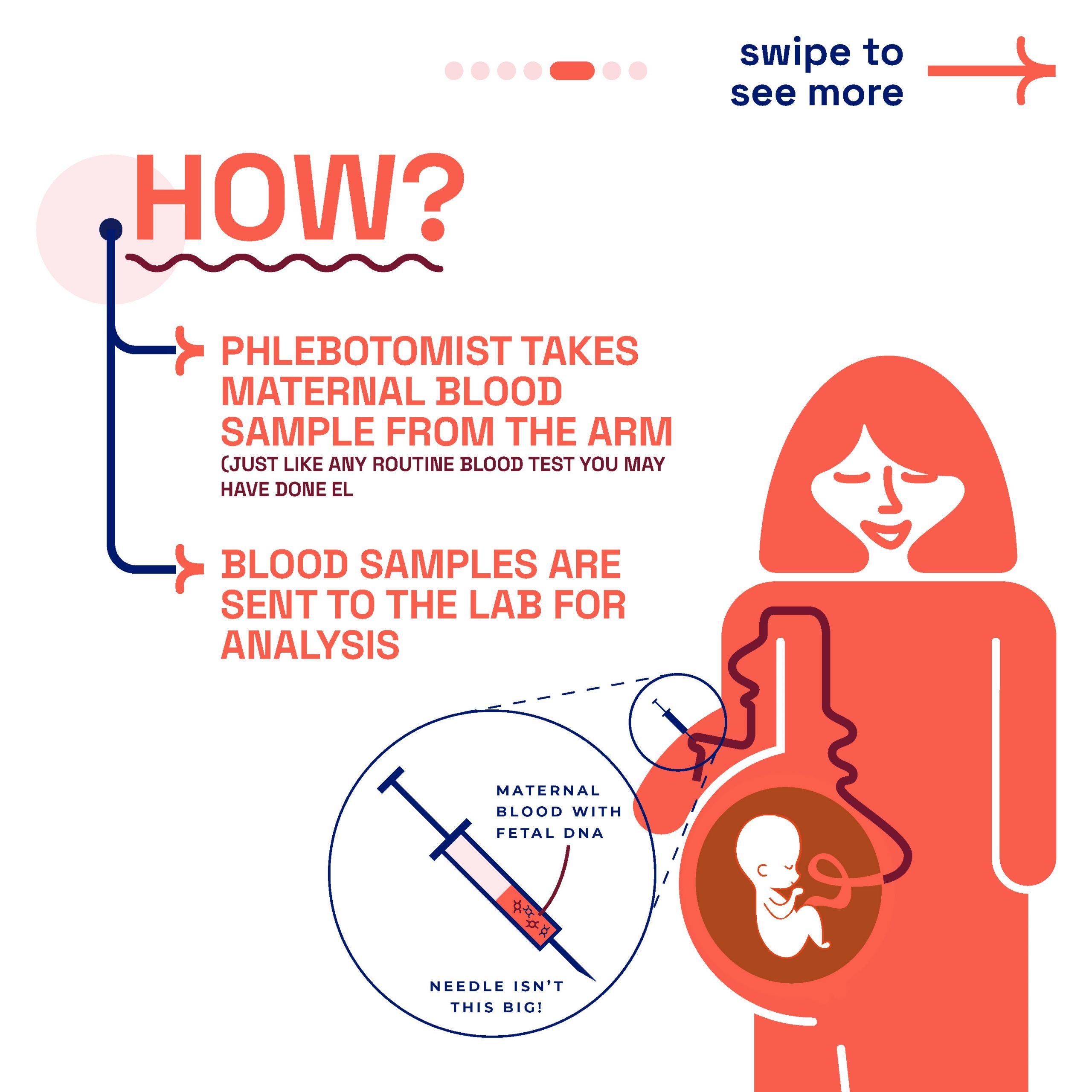 Illustrative guide by London Pregnancy Clinic on how NIPT is performed, showing a phlebotomist taking a blood sample and the process of lab analysis for fetal DNA.