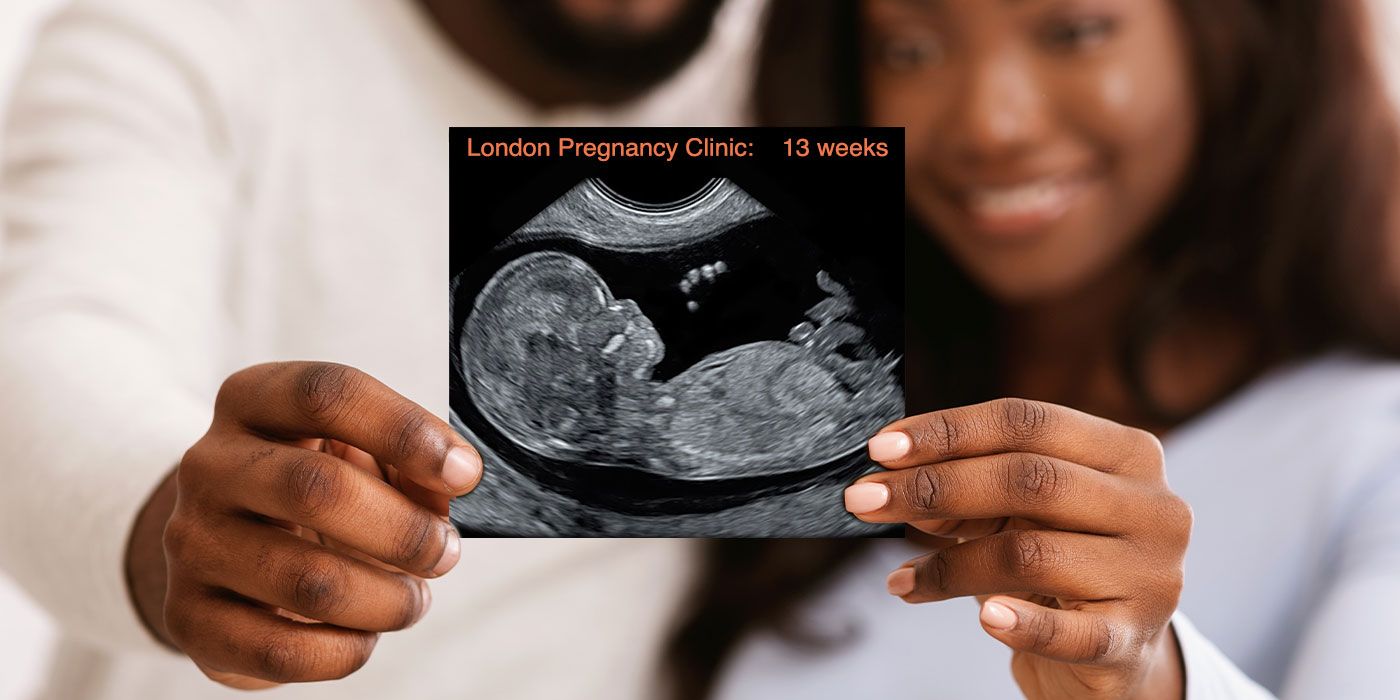 Early Pregnancy Scans we offer in London. A picture of a couple holding a picture of an ultrasound scan image.